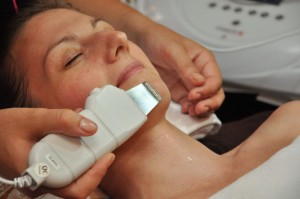 Peeling kawitacyjny